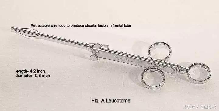 他用一根长钉从眼眶锤入那个人的头颅竟只为了治精神病