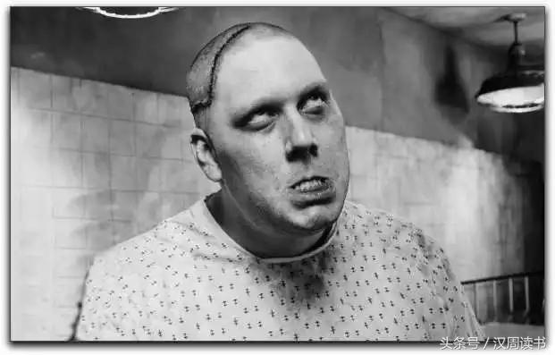 他用一根长钉从眼眶锤入那个人的头颅竟只为了治精神病