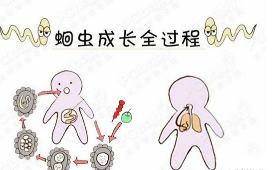 孩子拉出一条虫怎么办,儿童拉屎有虫是什么虫