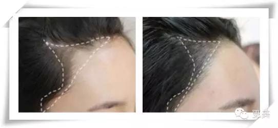 韩式半永久,韩式半永久都有什么