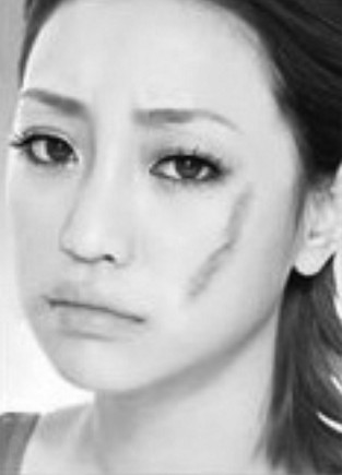 伤口怎样不留疤痕最好的方法,皮肤伤口怎么不留疤痕