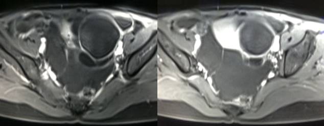 女性下腹疼痛是什么病,女性下腹疼痛的预兆