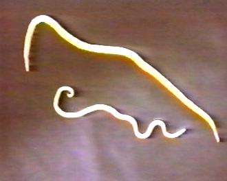 孩子拉出一条虫怎么办,儿童拉屎有虫是什么虫