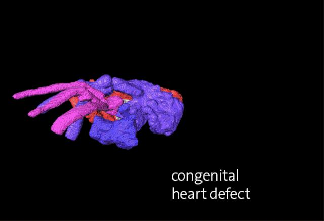 孕妇发烧了是吃药还是硬扛,孕妇发烧会不会影响宝宝智力