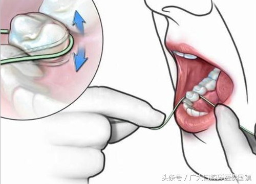 牙槽骨萎缩是什么症状,牙齿太久不咀嚼会牙槽骨萎缩吗