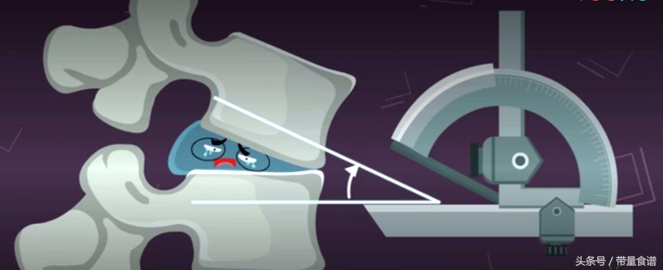 坐不久站不久用什么治疗,刚刚腰椎间盘突出怎么办