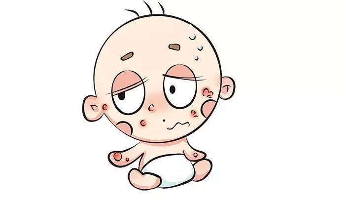 孕晚期怎么除胎毒,孕晚期怎么去胎毒最有效