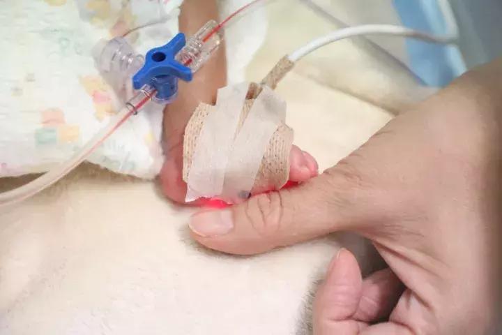 生命奇迹丨1100g，30周早产儿，心脏手术怎么做？