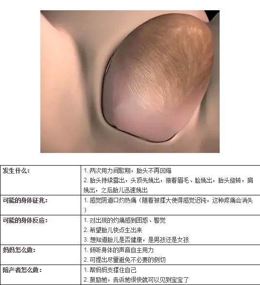 生娃就像拉便便一样？超详细的第二产程