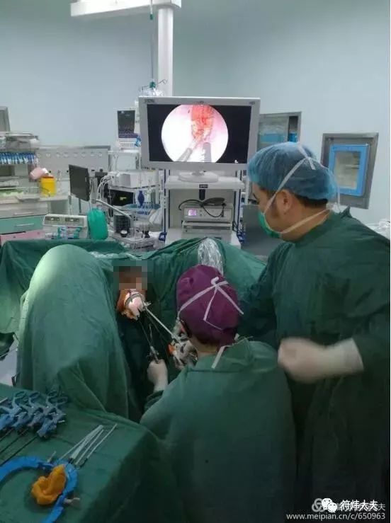 护菊行动，我们一直在努力！——徐医附院胃肠外科再攀高峰，常规开展腹腔镜经肛直肠癌根治手术,TaTME