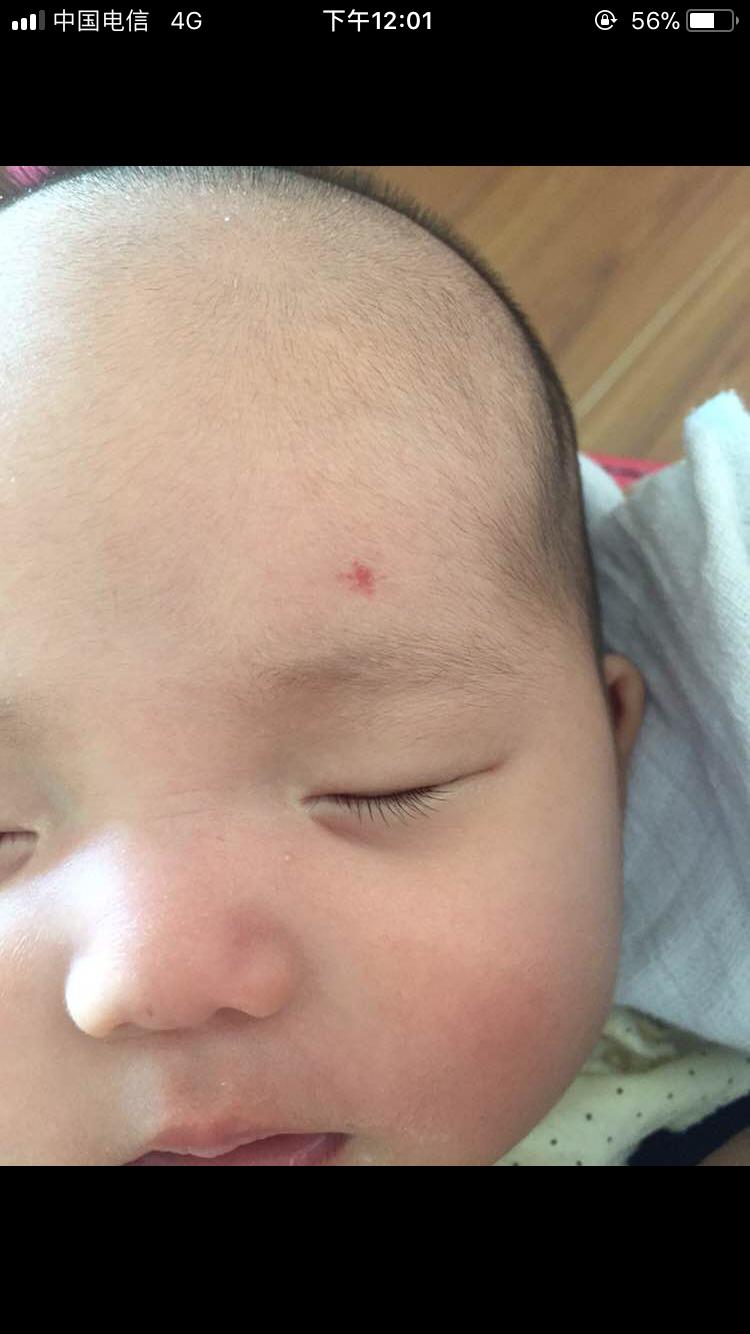 宝宝出生就有胎记是宝妈的原因吗,宝宝有胎记的宝妈们都去了吗