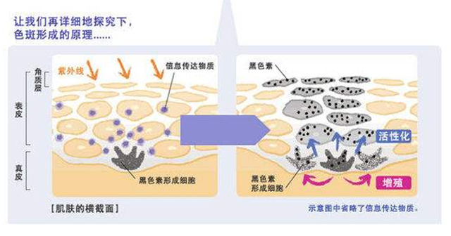 去看皮肤科治疗雀斑问什么问题,去医院什么科治疗雀斑