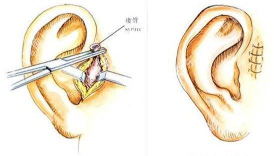 仓眼为什么是黑色,为什么会有仓眼