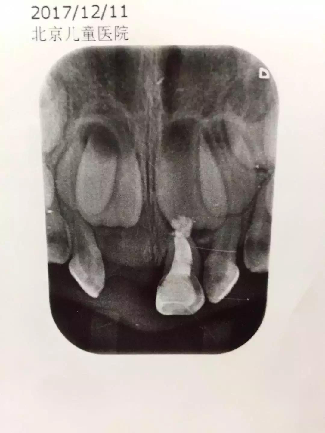 带孩子看牙医怎么不被坑,带孩子看牙花钱