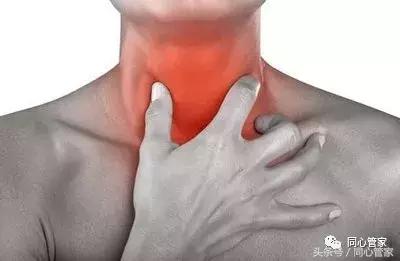 大盘点！支架术后最常见的9大症状，你中招了几条？