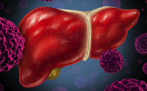 不可忽视的风险有哪些,不可轻视的肝损害免疫性肝炎