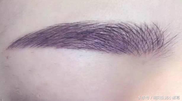 南阳时光微整形,南阳时光整形好还是天后整好