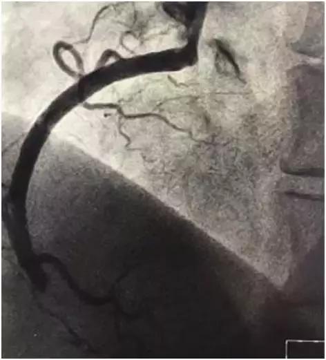 一天抢救两次,一天抢救两次还有救吗