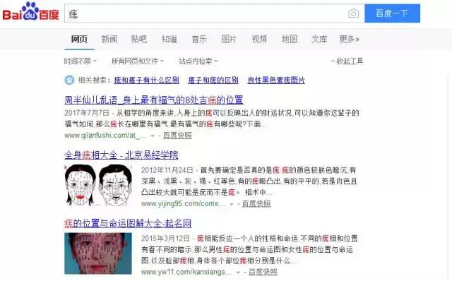 人中痣点痣过程,点痣要看痣图吗