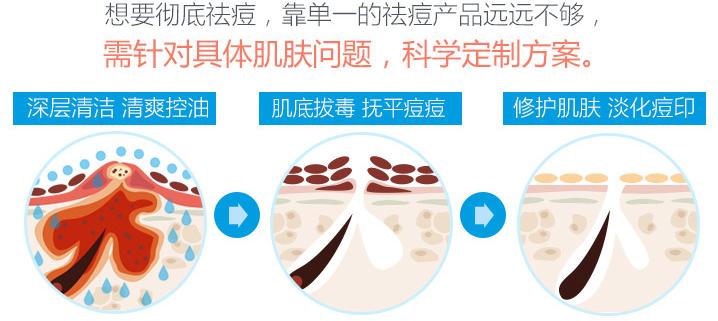 真正有效的祛痘方式,真正能祛痘的偏方