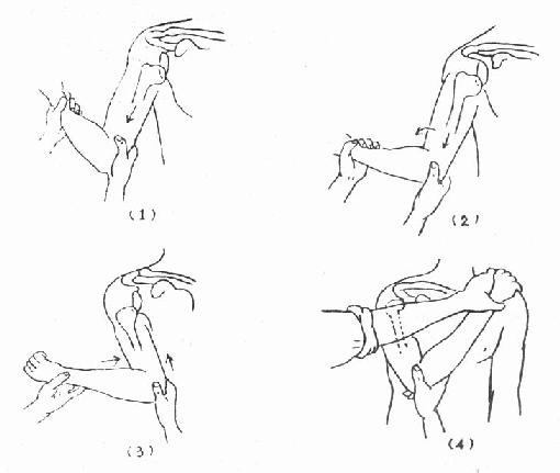 小儿桡骨头半脱位的治疗视频,小儿桡骨头半脱位复位