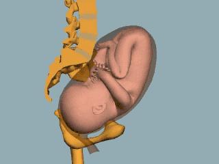 哪些人不适合做产后骨盆修复,不做骨盆修复自己能恢复好吗