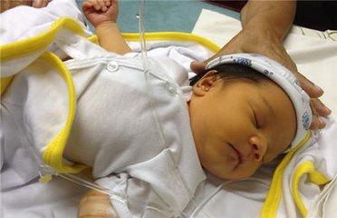 新生儿黄疸的类型及处理方法,新生儿黄疸不用慌消退黄疸有妙招