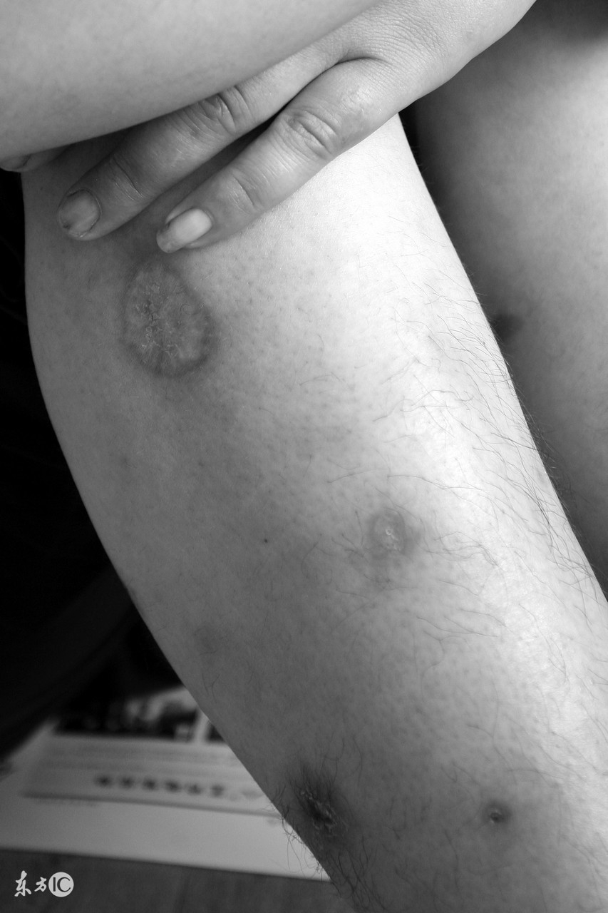 戒毒人员讲的故事,戒毒人员的故事