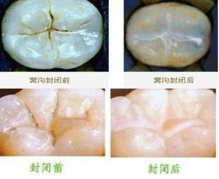 那些年我们错过的日子,那些年我们错过的事