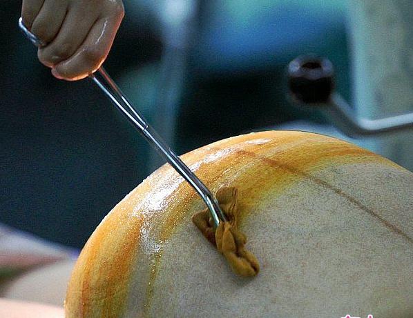 经历了剖腹产才知道妈妈的不容易,看完剖宫产过程你就会明白