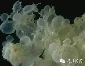 怀孕后竟然来了大姨妈?医生说:那不是好姨妈!