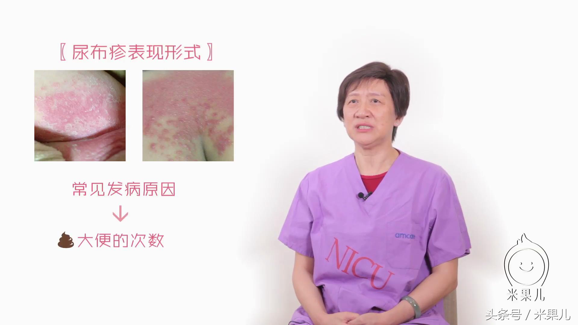 宝宝身上出现疹子该如何处理,如何分辨宝宝身上的疹子