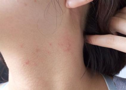 脖子发胀难受怎么回事怎么调理,脖子出现这三种特征可能已患大病