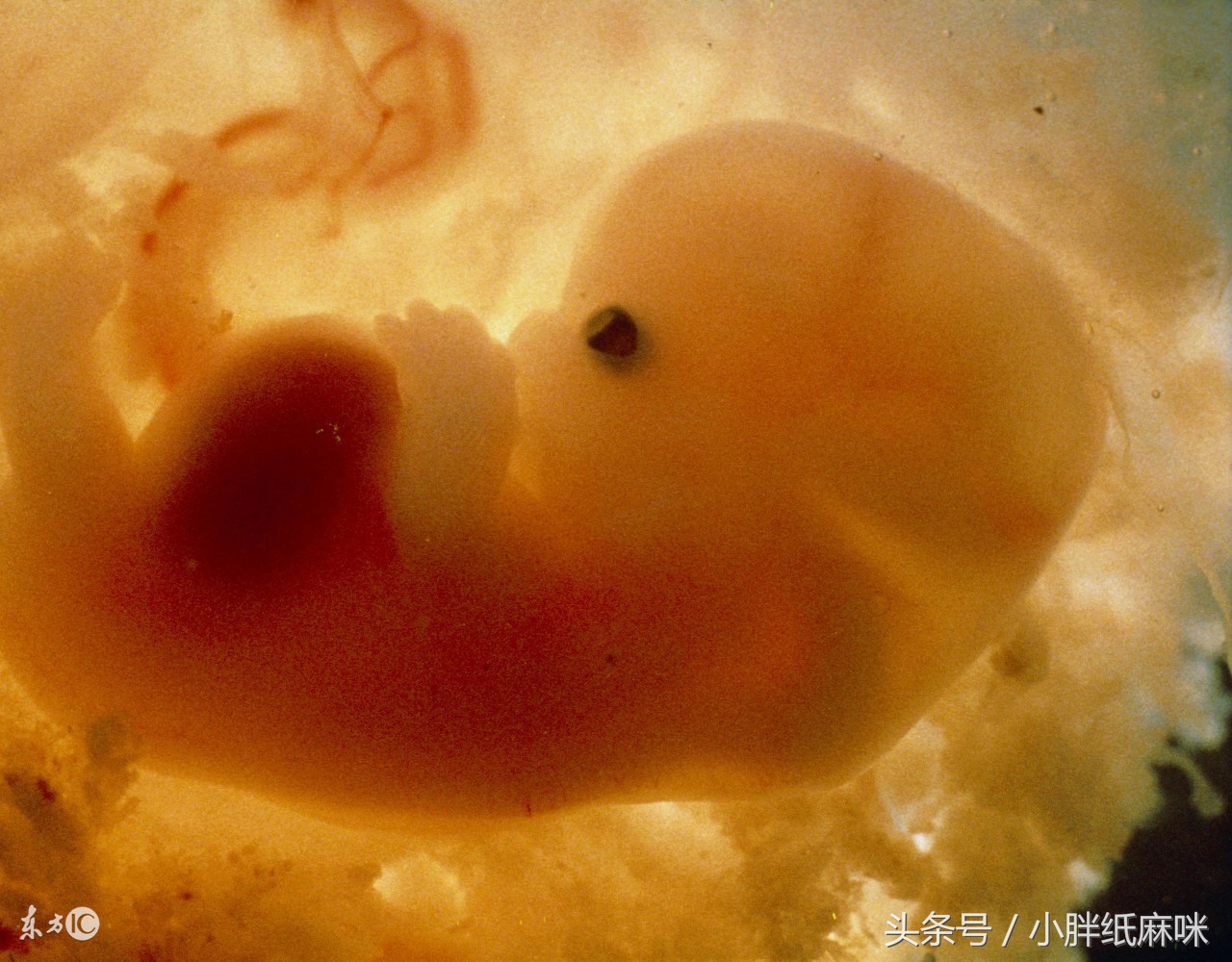 为什么70%的怀孕女性都会流产？怎么避免和宝宝说“再见”？快看