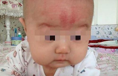 一岁半的宝宝摔下床摔到头了,一岁宝宝掉下床额头摔了个大包