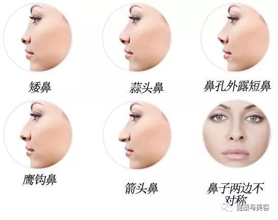 杨幂、唐嫣、神仙姐姐的鼻子原来是这样“整的”！