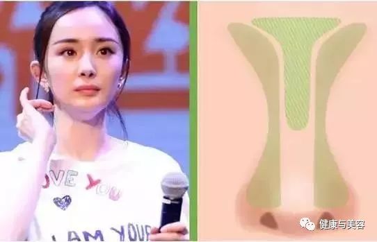 杨幂、唐嫣、神仙姐姐的鼻子原来是这样“整的”！