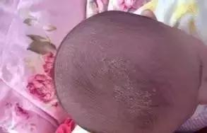 不要慌！新生宝宝这21种情况不是病！「爱贝佳月嫂讲堂」