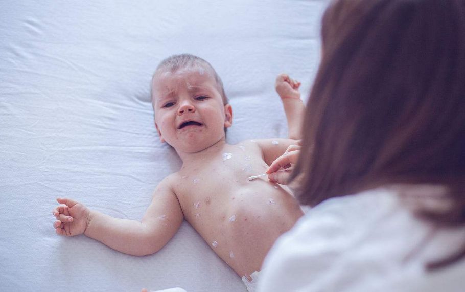 辽宁省疾控发布重要提醒：这种自费疫苗不仅要打，还得打两次！