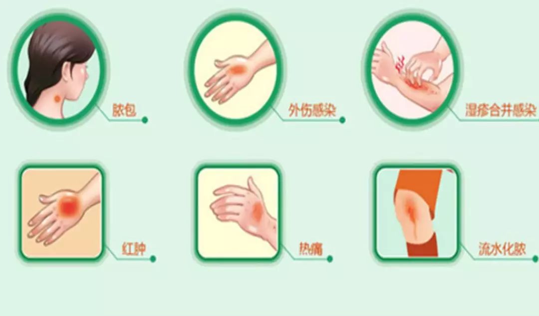 部队军医怎么训练,军医在线训练视频教程