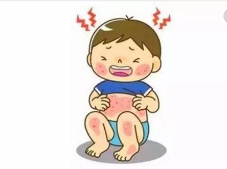 宝宝湿疹反复发作怎么办？专职妈妈教你三招，不到一个星期就见效