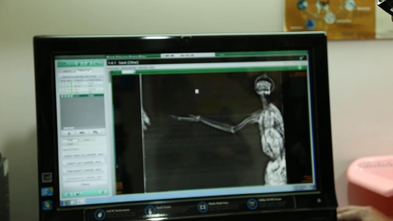 蟒蛇消化不良拉肚子,野生动物园泰国蟒蛇