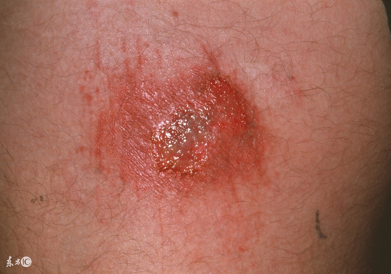 依马打红花油怎么样,依马打正红花油是哪里的