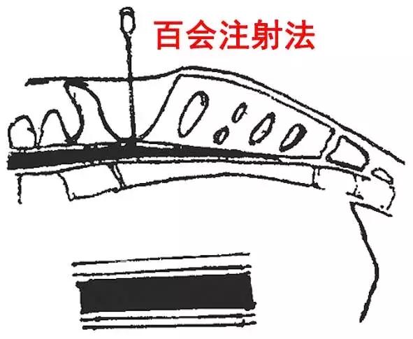 穴位治病大全20招,穴位疗法十大手法