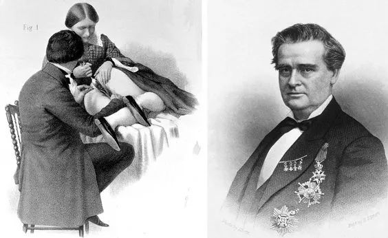 11位*奴女**5年遭受近50次痛苦手术，却成就了他“妇科之父”的荣耀