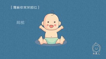 宝宝过敏怎么办新手爸妈秘籍,妈妈过敏体质宝宝怎么办