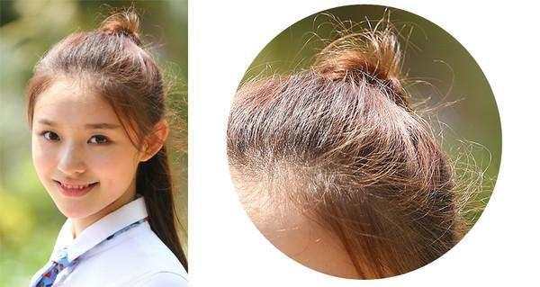 女宝碎头发太多怎么扎好看,从小碎头发太多是什么原因