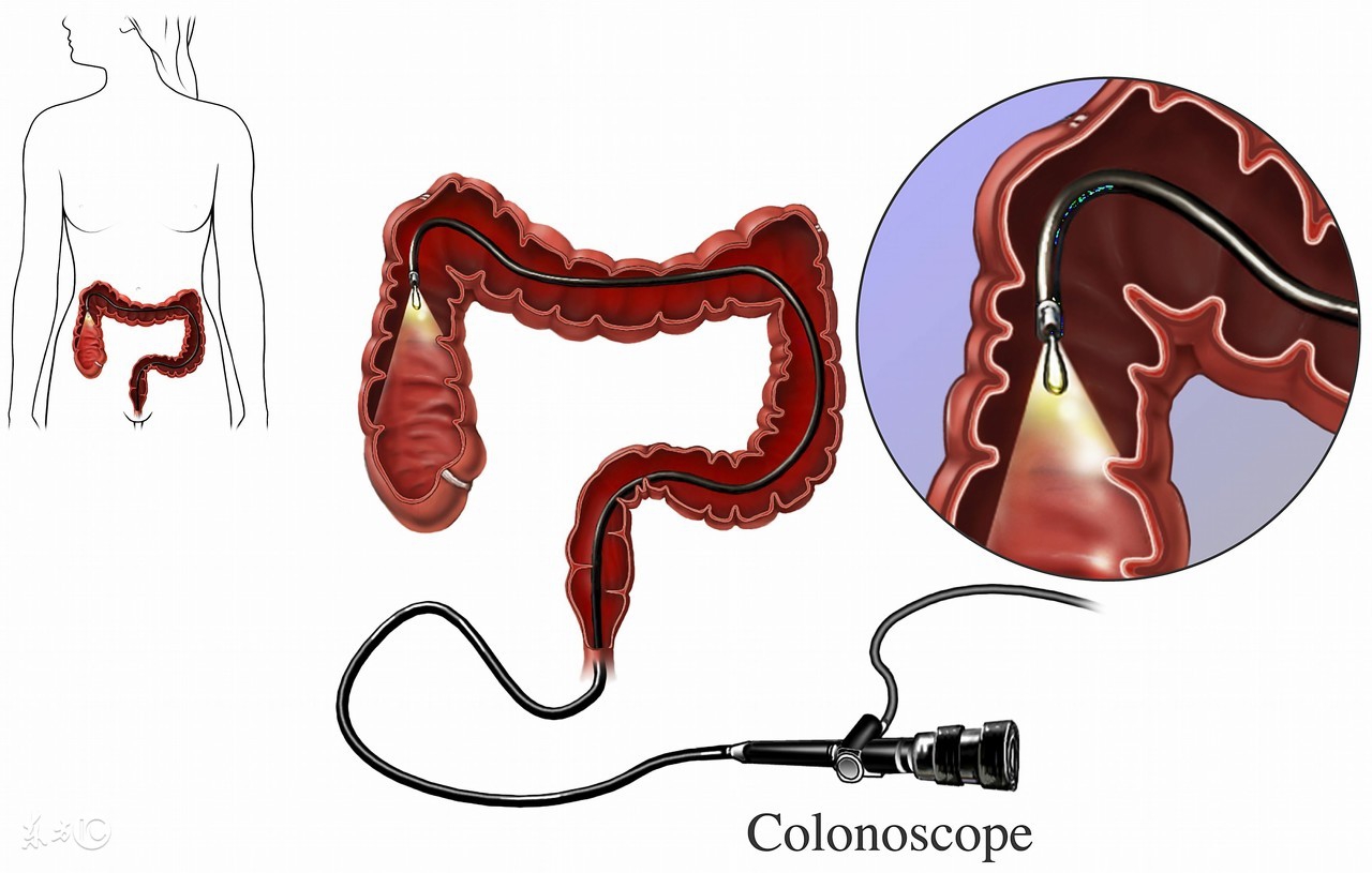 什么原因结肠异常扩张,结肠在什么情况下胀的慌