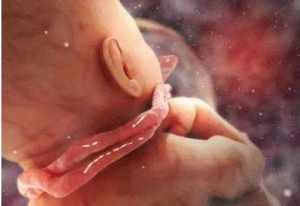 怀孕九个多月脐带绕颈三圈检查单,怀孕八个月脐带绕颈38周