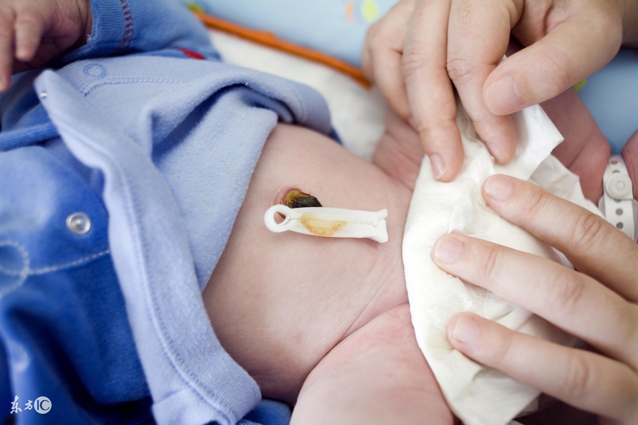 都是小小“脐带”惹的祸